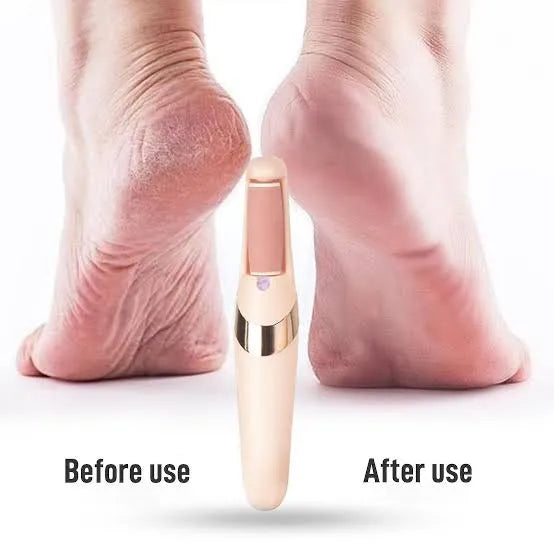 Pedi Electronic Pedicure Tool, File & Callous Remover